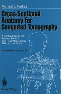 Cross-Sectional Anatomy for Computed Tomography [DRM] - Michael L. Farkas - ebook