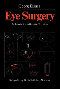 Eye Surgery [DRM] - Peter Niesel - ebook