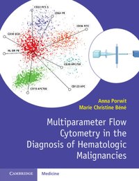 Multiparameter Flow Cytometry in the Diagnosis of Hematologic Malignancies [DRM] - Marie Christine Bene - ebook