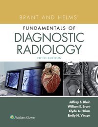 Brant and Helms' Fundamentals of Diagnostic Radiology [DRM] - Clyde A. Helms - ebook