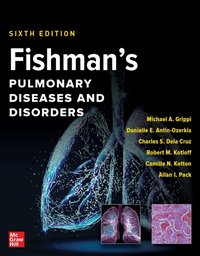 Fishman's Pulmonary Diseases and Disorders, 2-Volume Set, Sixth Edition [DRM] - Charles S. Dela Cruz - ebook