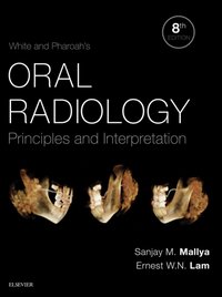 White and Pharoah's Oral Radiology [DRM] - Ernest Lam - ebook