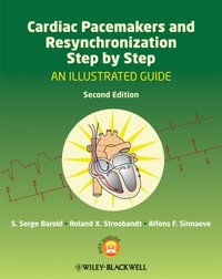 Cardiac Pacemakers and Resynchronization Step by Step [DRM] - Alfons F. Sinnaeve - ebook