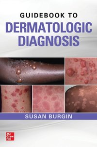 Guidebook to Dermatologic Diagnosis [DRM] - Susan Burgin - ebook