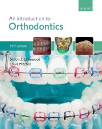 Introduction to Orthodontics [DRM] - Laura Mitchell - ebook