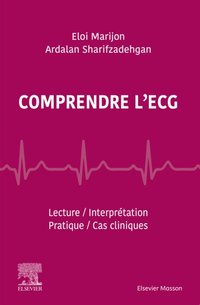 Comprendre l'ECG [DRM] - Annaick PERON - ebook