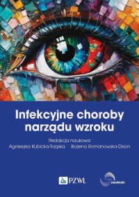 Infekcyjne choroby narządu wzroku - Bożena Romanowska-Dixon - ebook