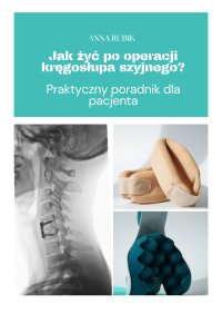 Jak żyć po operacji kręgosłupa szyjnego? Praktyczny poradnik dla pacjenta - Anna Rubik - ebook