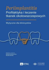 Periimplantitis. Profilaktyka i leczenie tkanek okołowszczepowych - Renata Górska - ebook