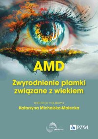 AMD Zwyrodnienie plamki żółtej związane z wiekiem - Katarzyna Michalska-Małecka - ebook