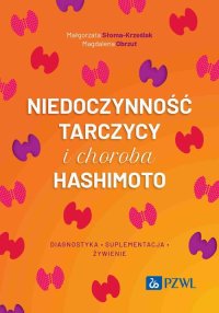 Niedoczynność tarczycy i choroba Hashimoto - Magdalena Obrzut - ebook